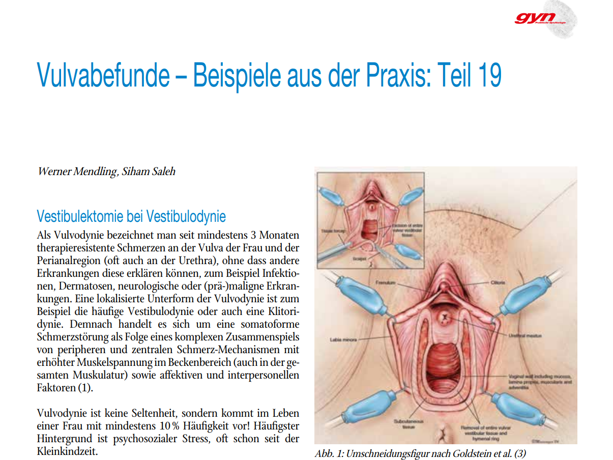 Vulvabefunde – Beispiele aus der Praxis | Prof. Dr. med. Werner ...